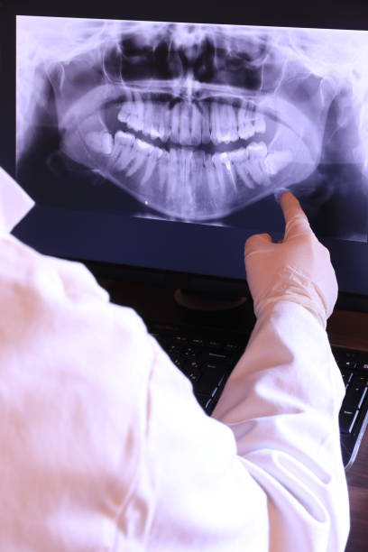 Best Emergency Denture Repair in Chebanse, IL